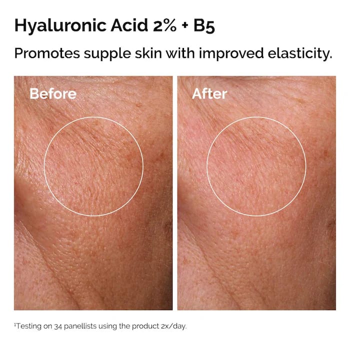 The Skin Support Set